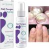 Nail Fungus Spray