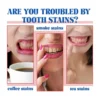 2 Pcs SP-6 Ultra Whitening Toothpaste